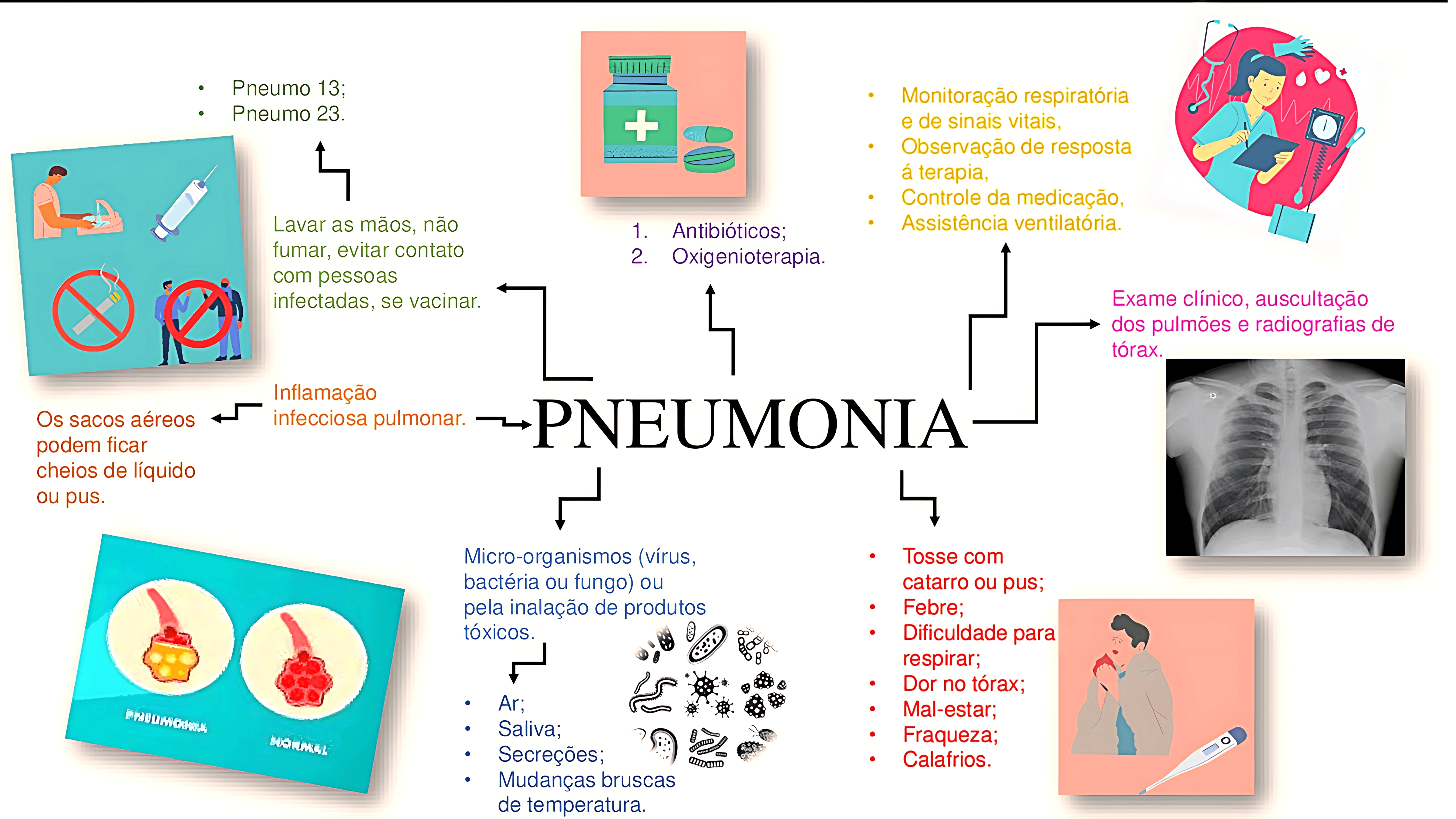 MAPA MENTAL SOBRE PNEUMONIA