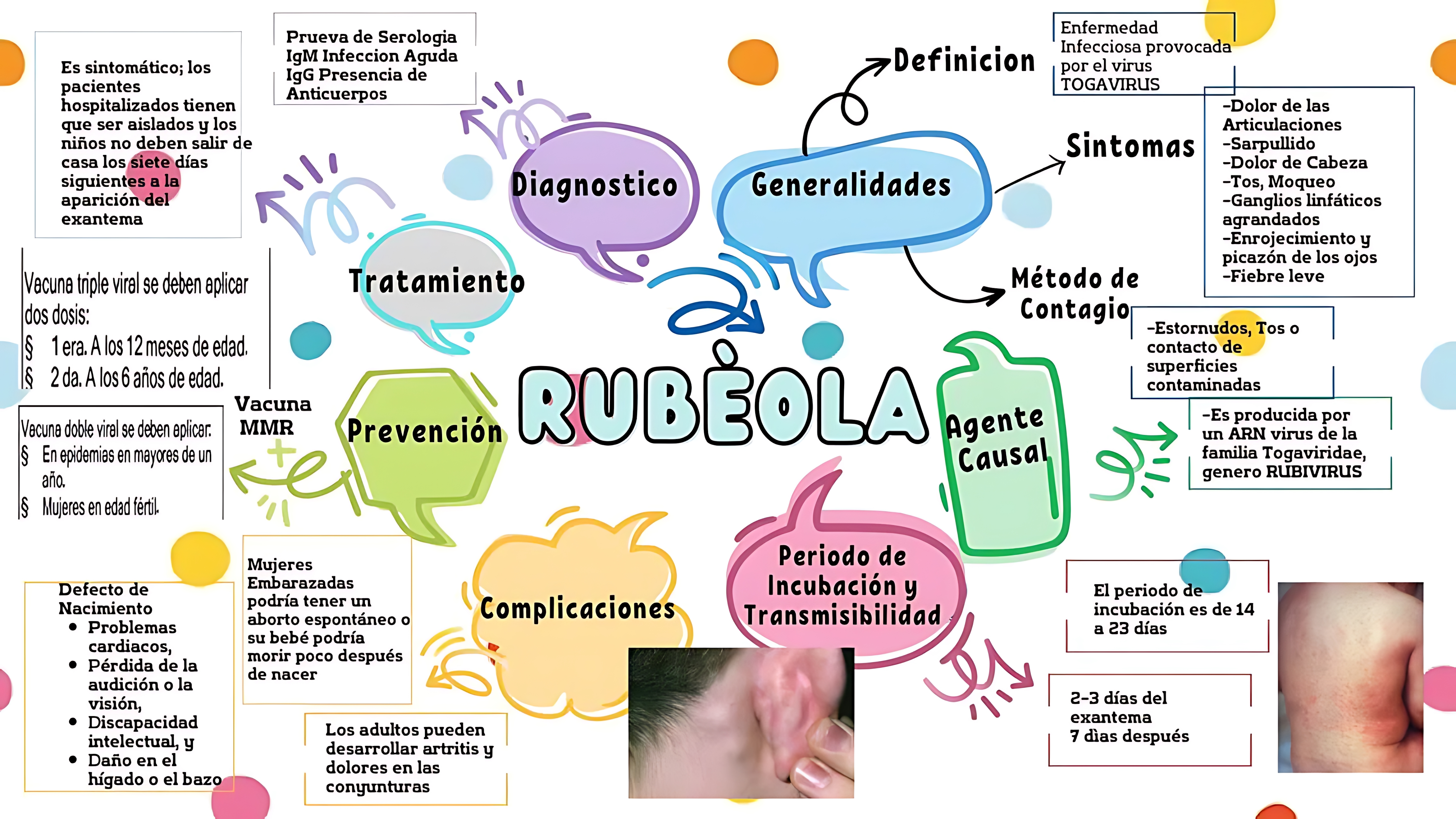 MAPA MENTAL SOBRE RUBÉOLA