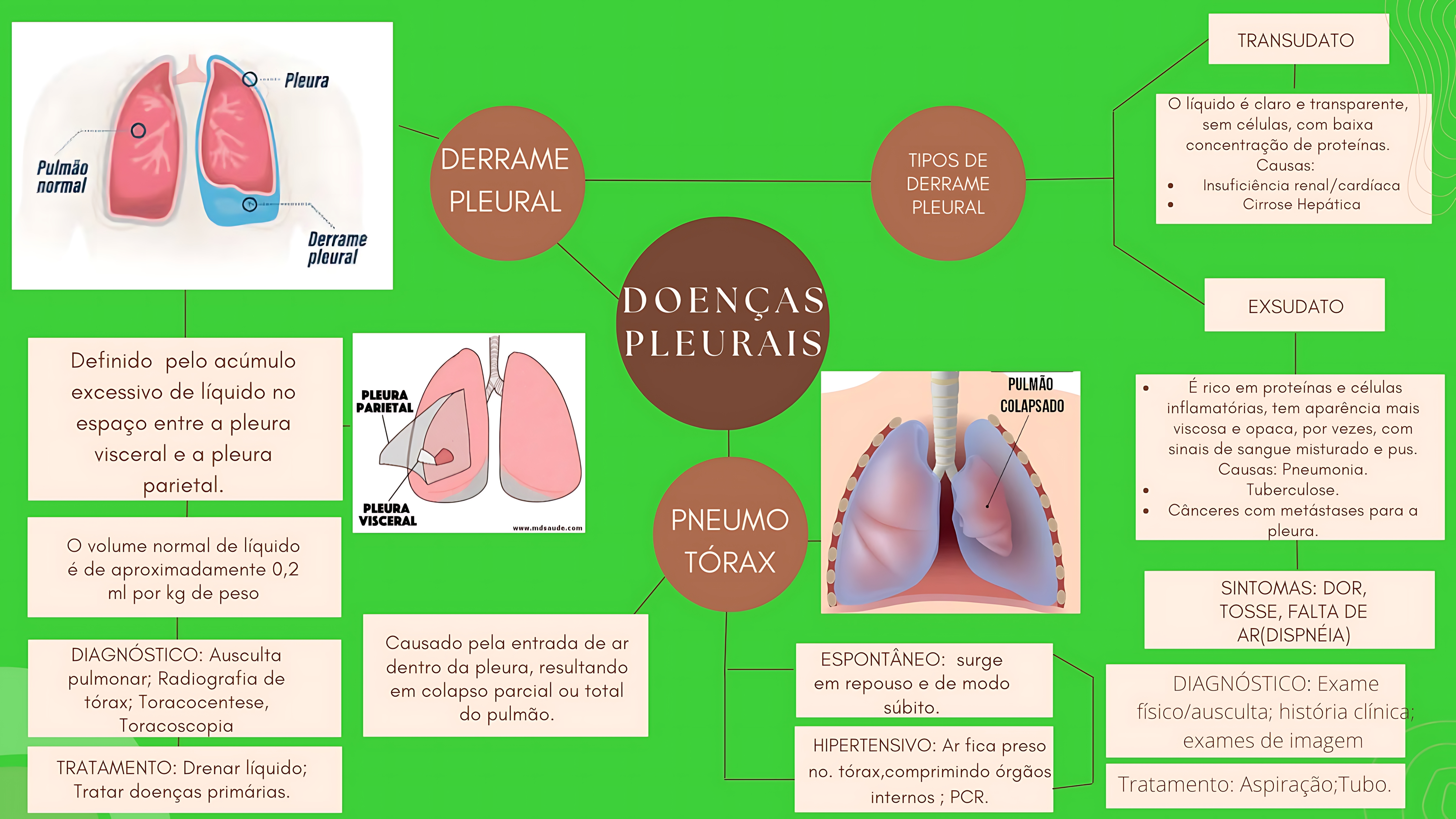 MAPA MENTAL SOBRE DERRAME PLEURAL