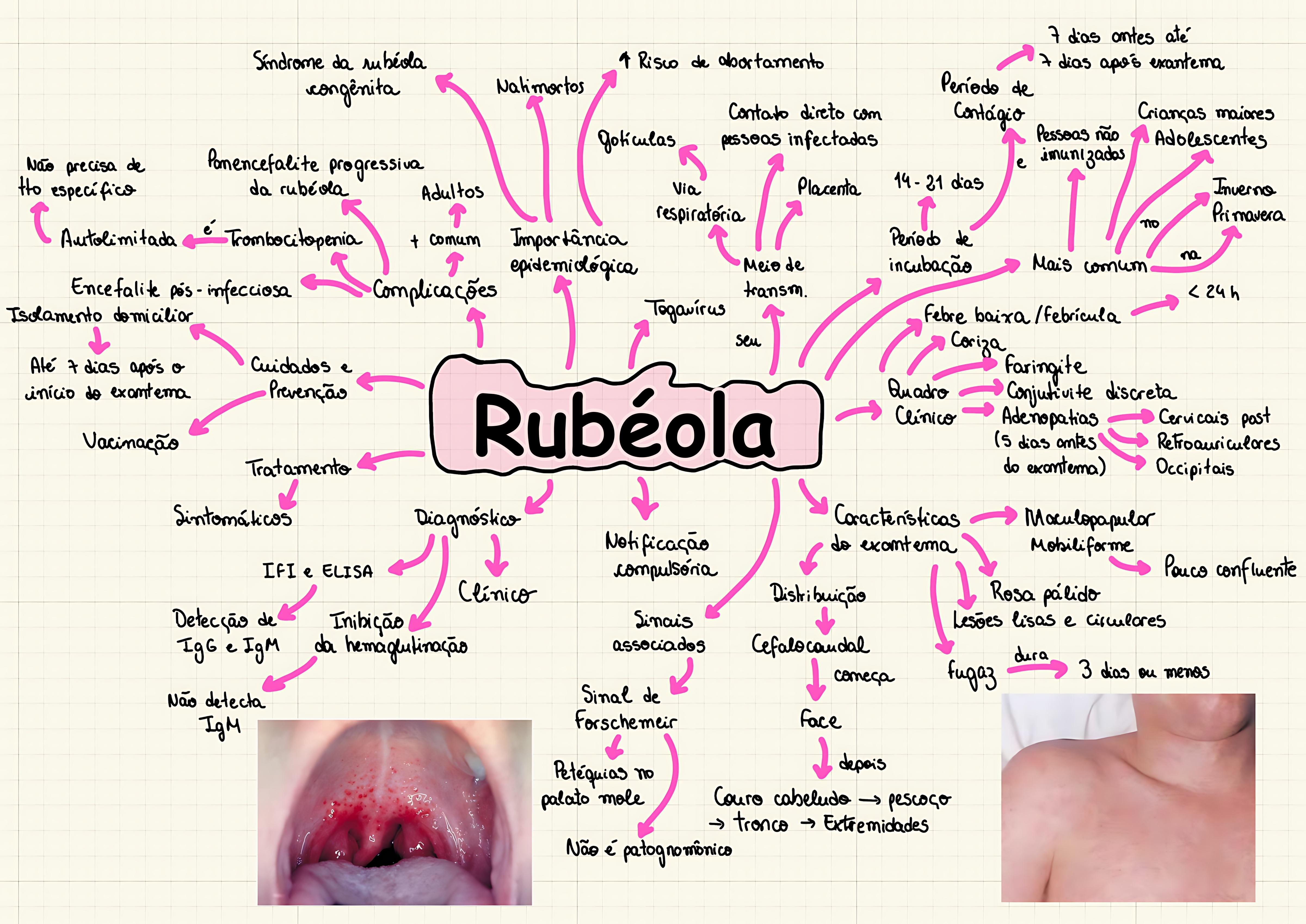 MAPA MENTAL SOBRE RUBÉOLA