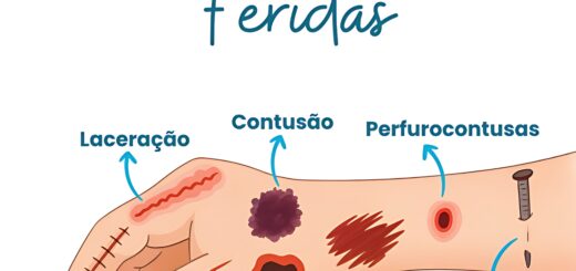 MAPA MENTAL SOBRE TIPOS DE FERIDAS