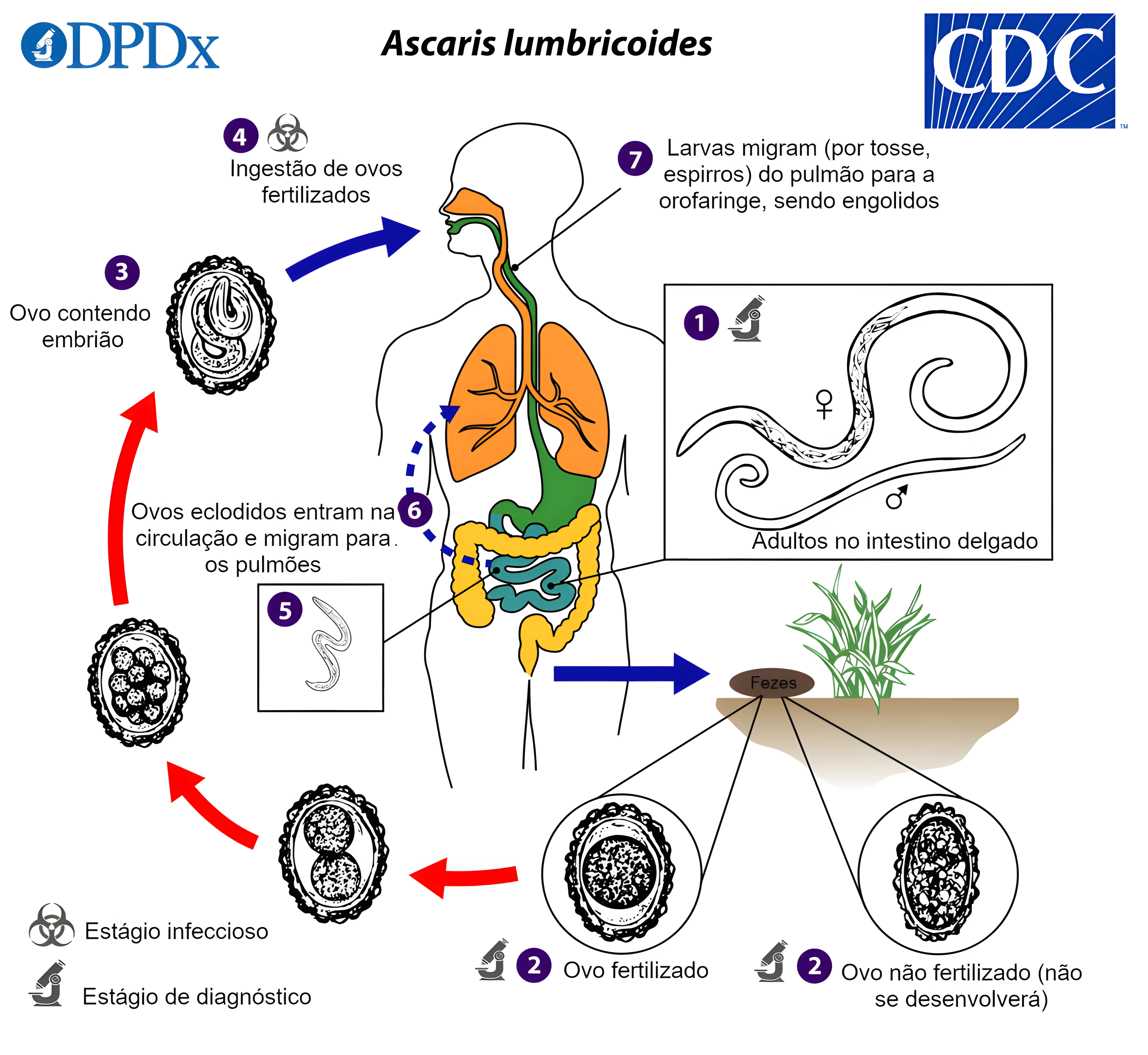 MAPA MENTAL SOBRE ASCARIDIASE