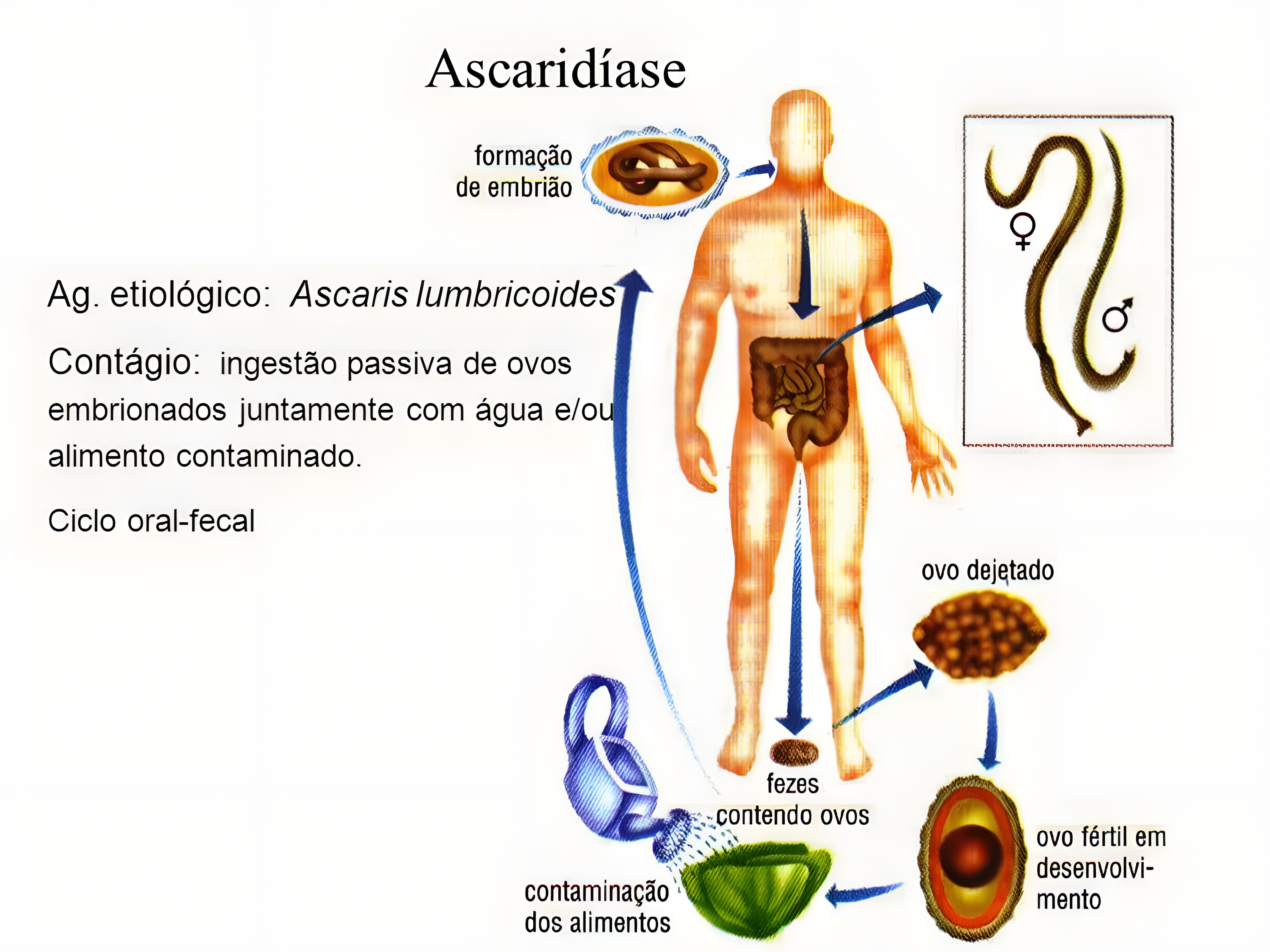 MAPA MENTAL SOBRE ASCARIDIASE