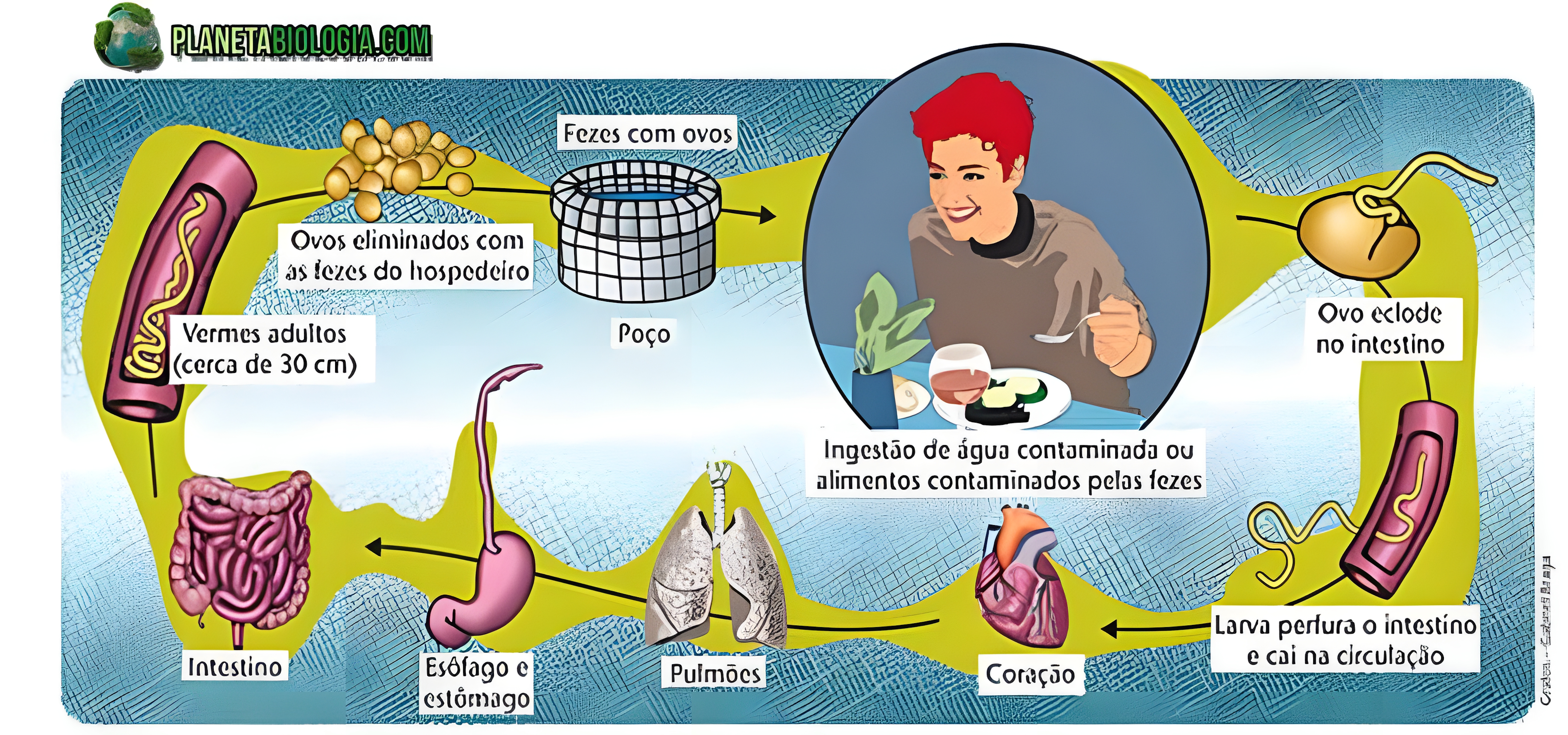 MAPA MENTAL SOBRE ASCARIDIASE