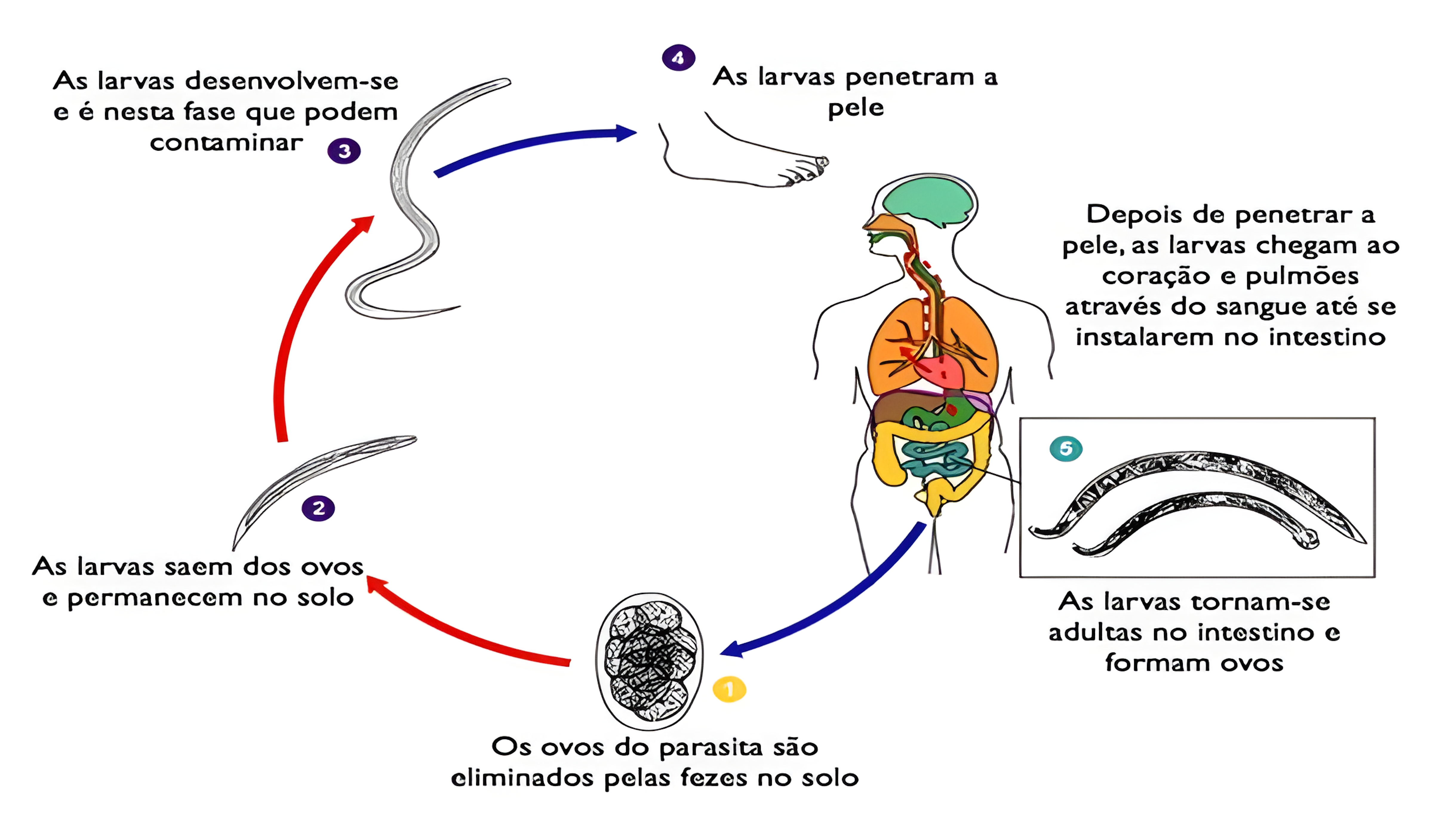MAPA MENTAL SOBRE ASCARIDIASE