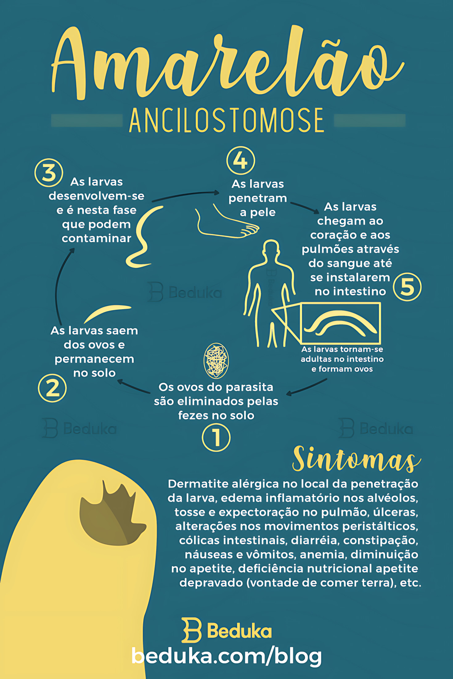 MAPA MENTAL SOBRE ANCILOSTOMOSE