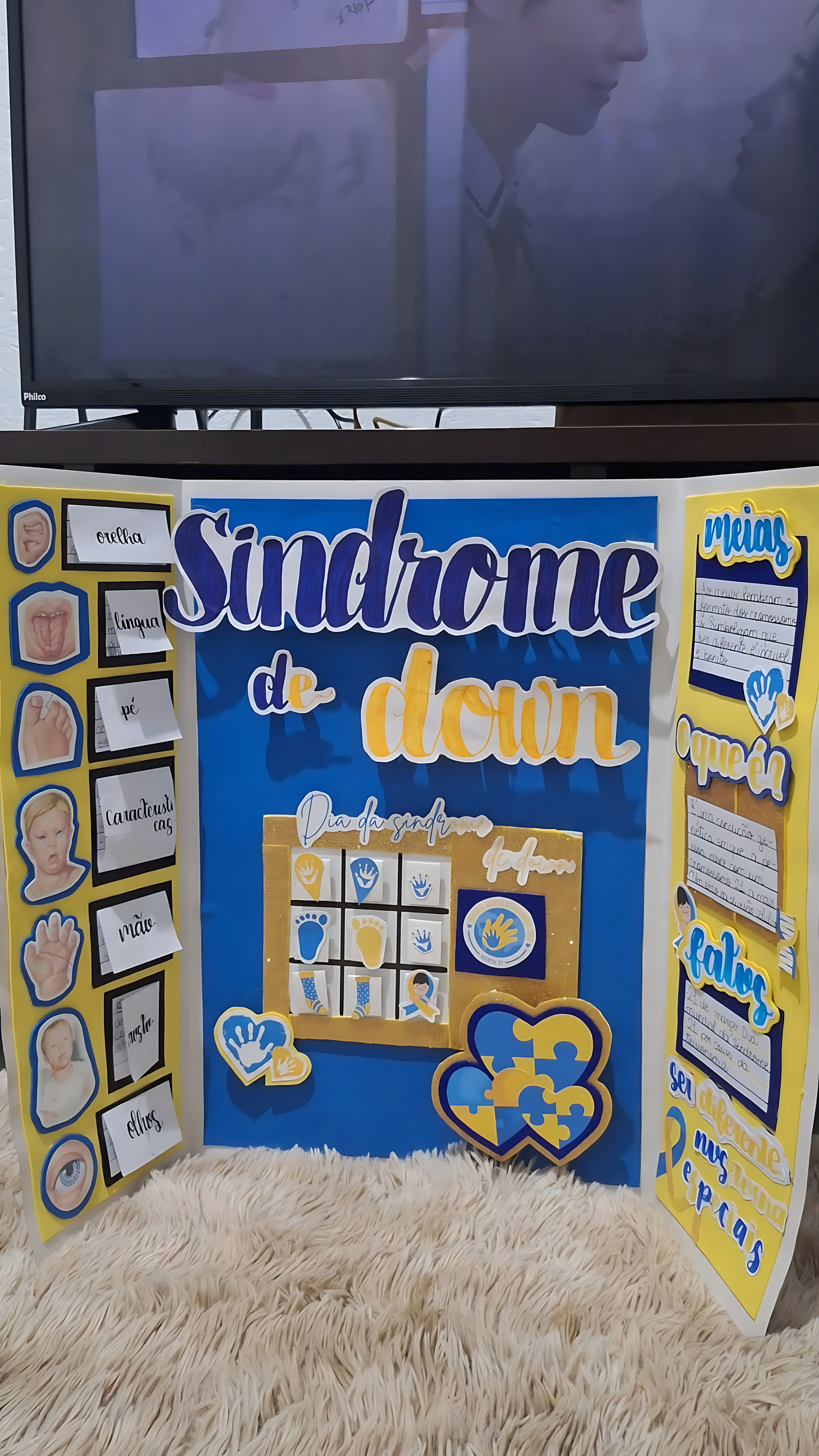 MAPA MENTAL SOBRE SÍNDROME DE DOWN