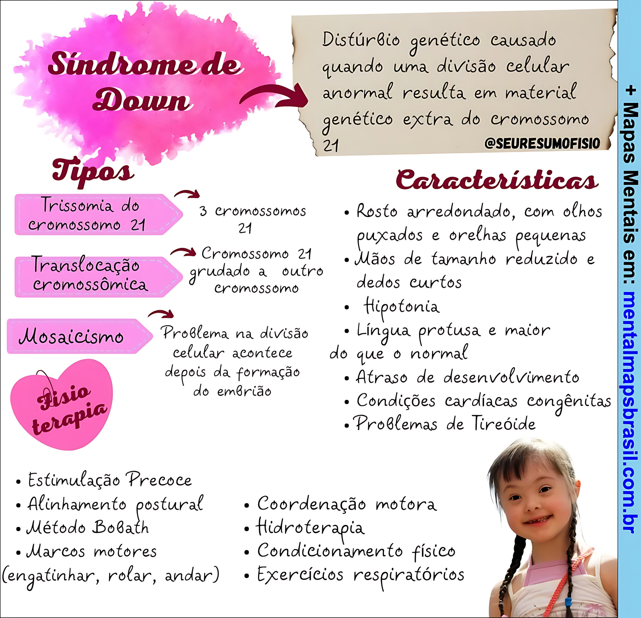 MAPA MENTAL SOBRE SÍNDROME DE DOWN
