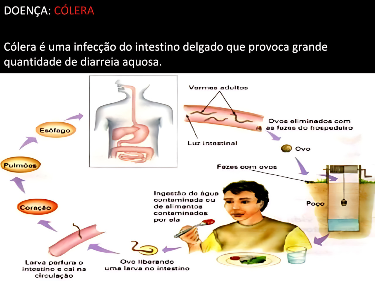 MAPA MENTAL SOBRE CÓLERA