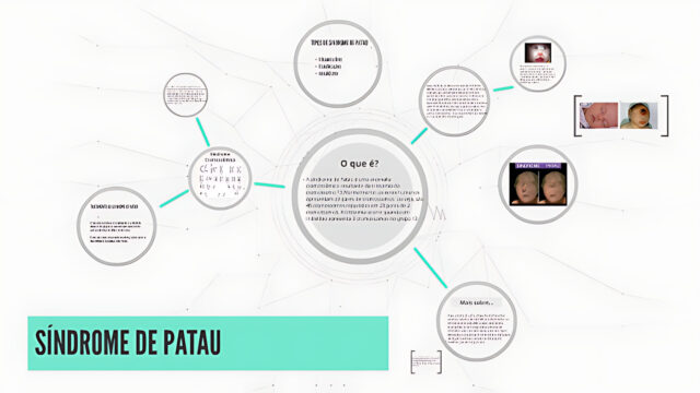 SÍNDROME DE PATAU