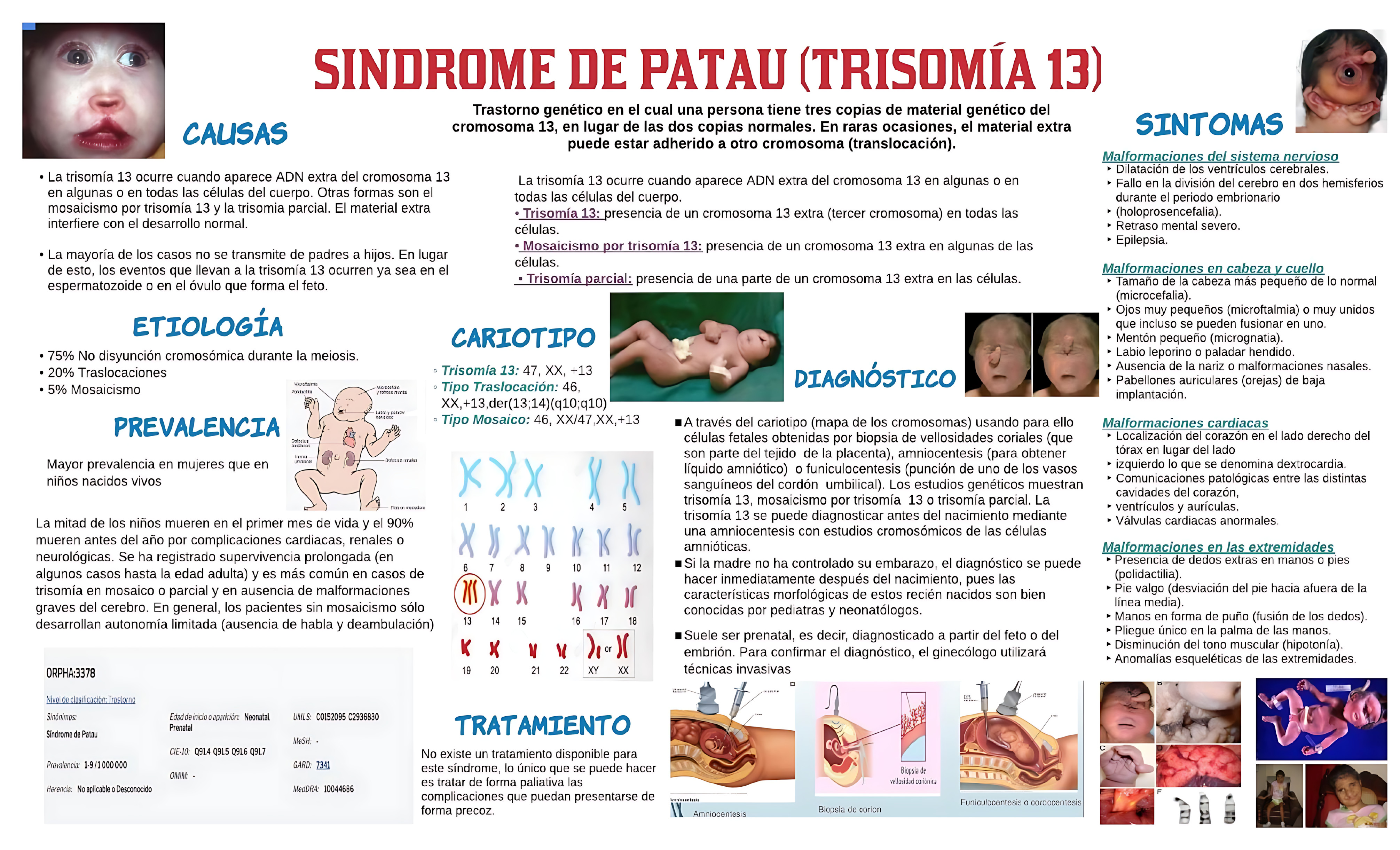 MAPA MENTAL SOBRE SÍNDROME DE PATAU