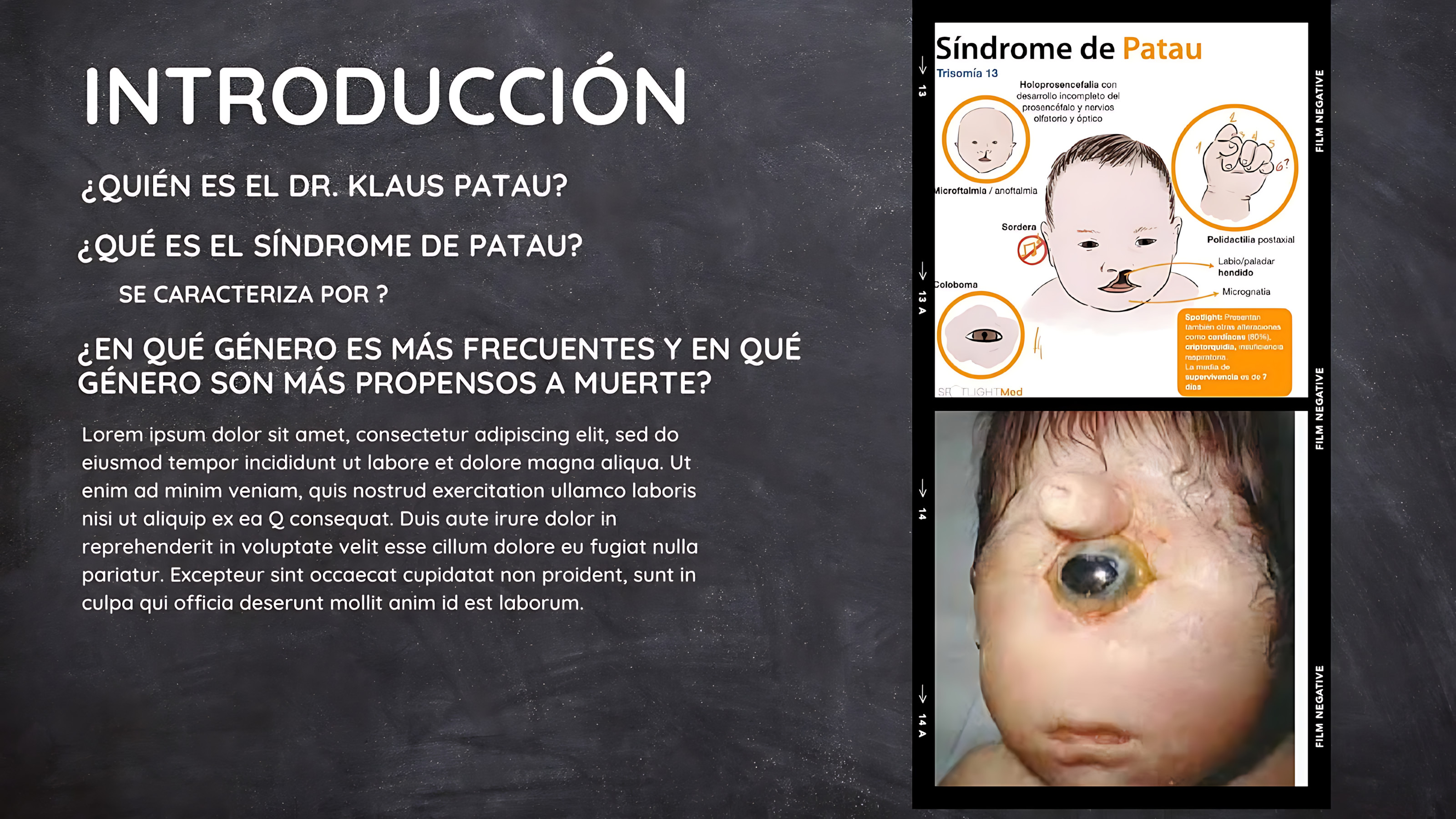 MAPA MENTAL SOBRE SÍNDROME DE PATAU