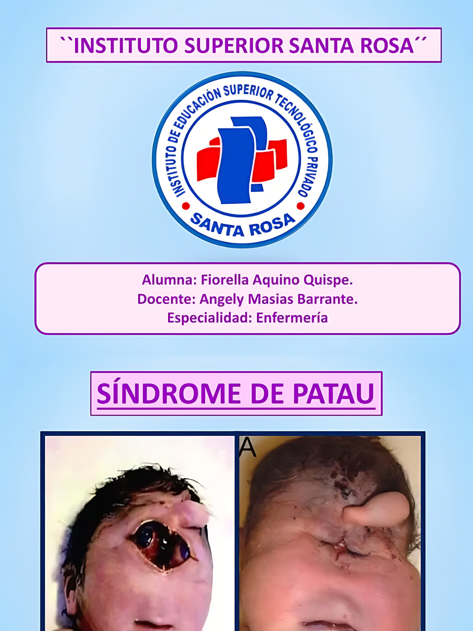MAPA MENTAL SOBRE SÍNDROME DE PATAU