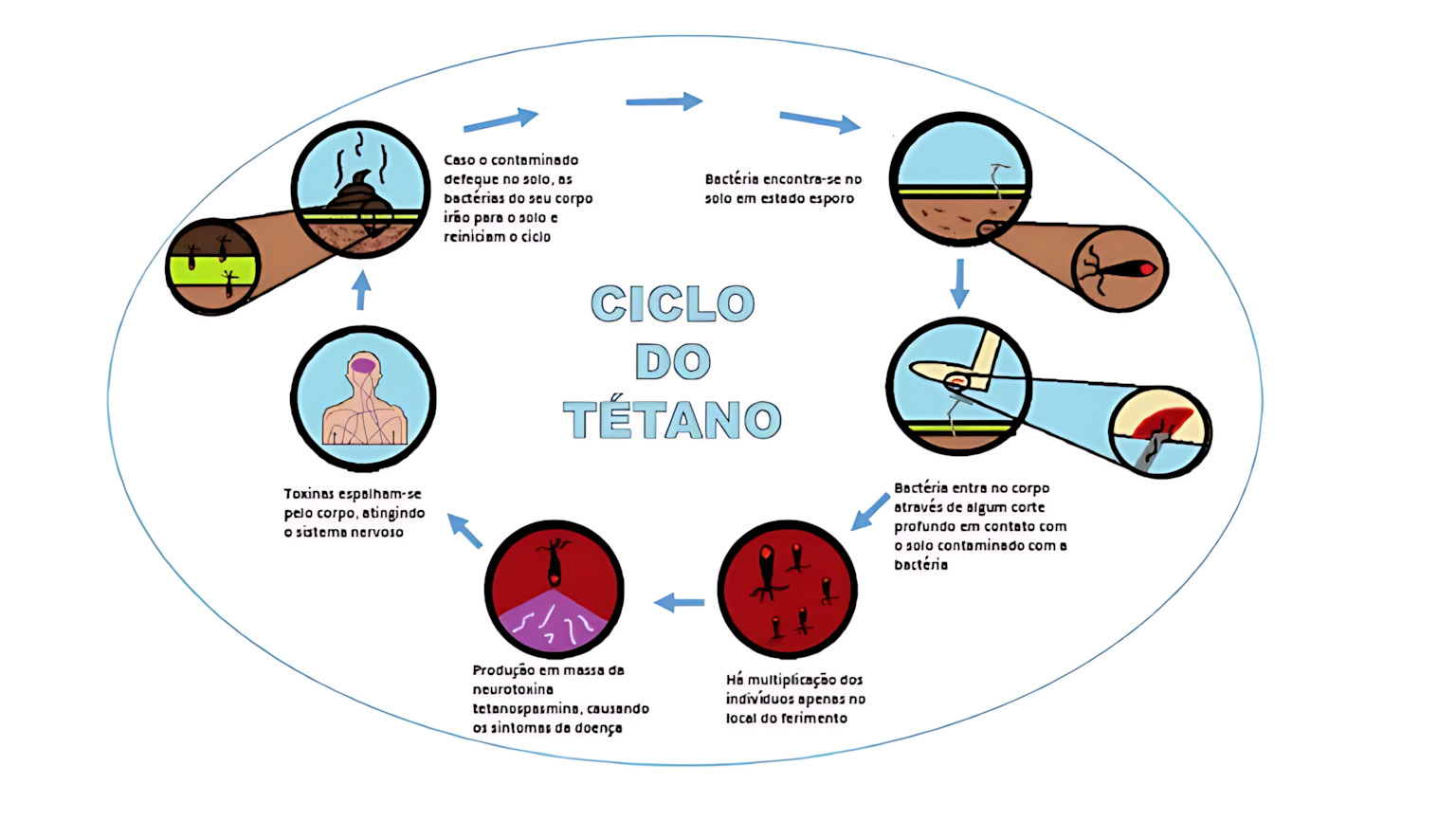 MAPA MENTAL SOBRE TÉTANO