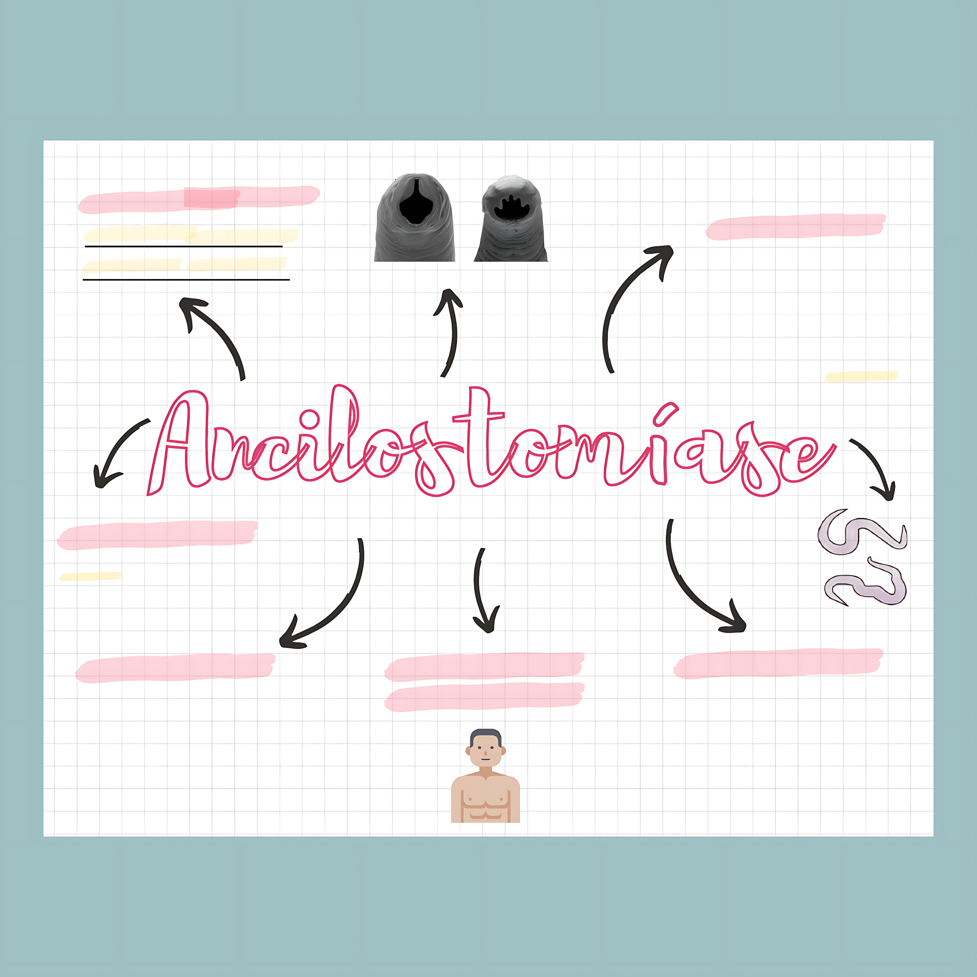 MAPA MENTAL SOBRE ANCILOSTOMOSE